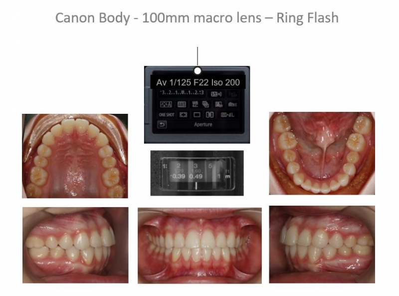 Dental Photography Learn How To Obtain High Quality Clinical Dental