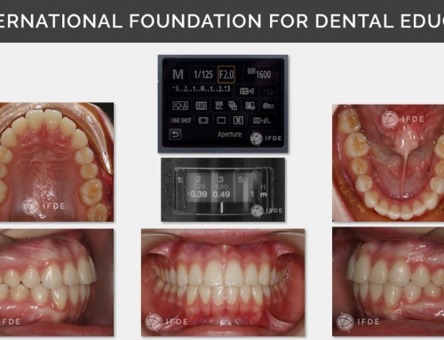 Dental Photography. Learn how to obtain high quality clinical dental photographs.