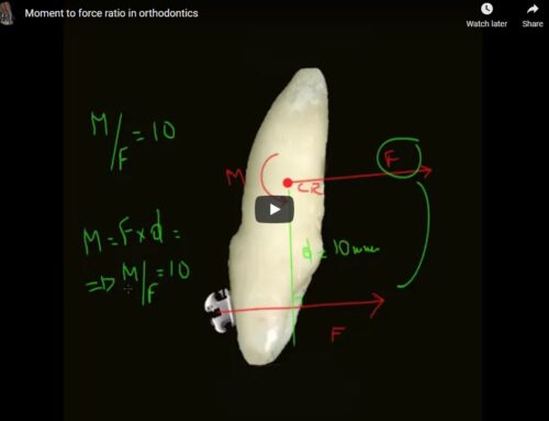 Moment to Force Ratio in Orthodontics (Video)