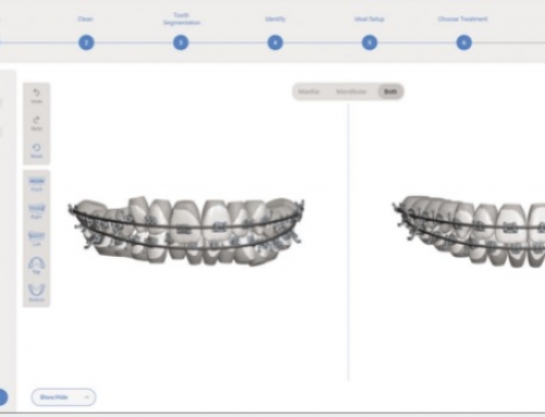 Article: The Role of AI in Contemporary Orthodontics