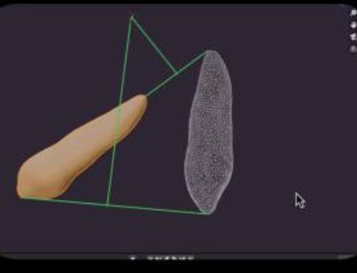 Center of Rotation vs Region of Rotation in Orthodontics